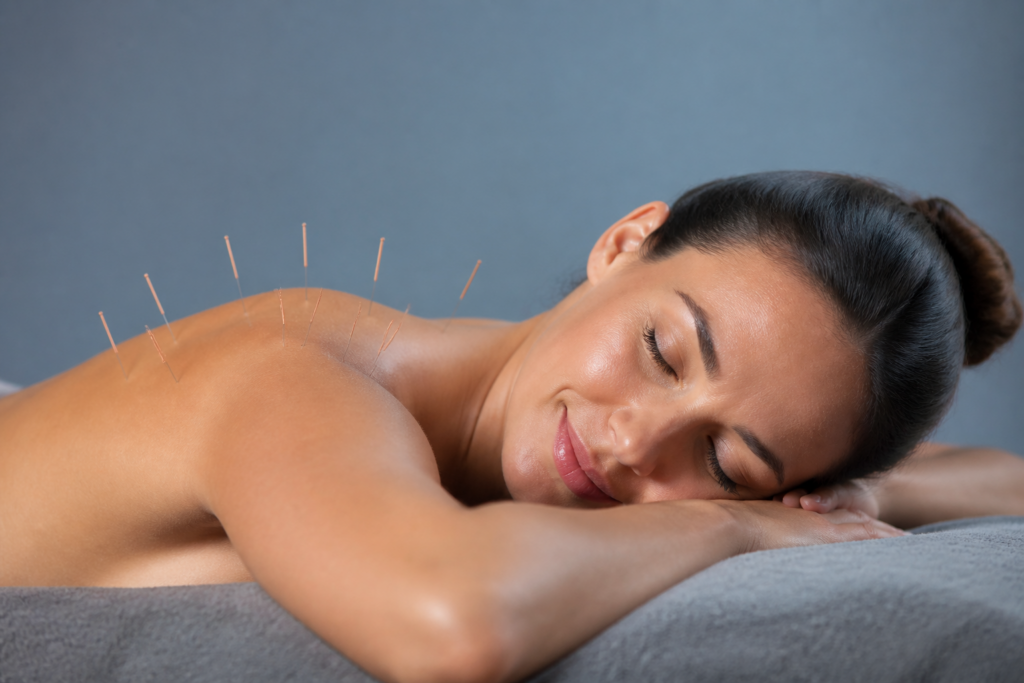 Acupuncture : indications, contre-indications et ce que dit la science